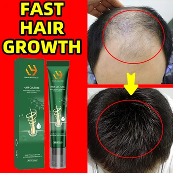 Новое Биотиновое масло для быстрого роста волос, Сыворотка для роста волос, средство для лечения выпадения волос, Густое масло для роста волос для мужчин и женщин, для восстановления роста волос